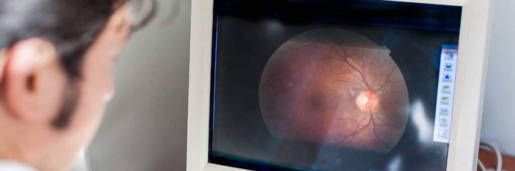 Oko na komputerze w badaniu.  Obrazek w artykule Uszkodzenie siatkówki oka objawy. Poznaj jakie są najczęstsze choroby oczu