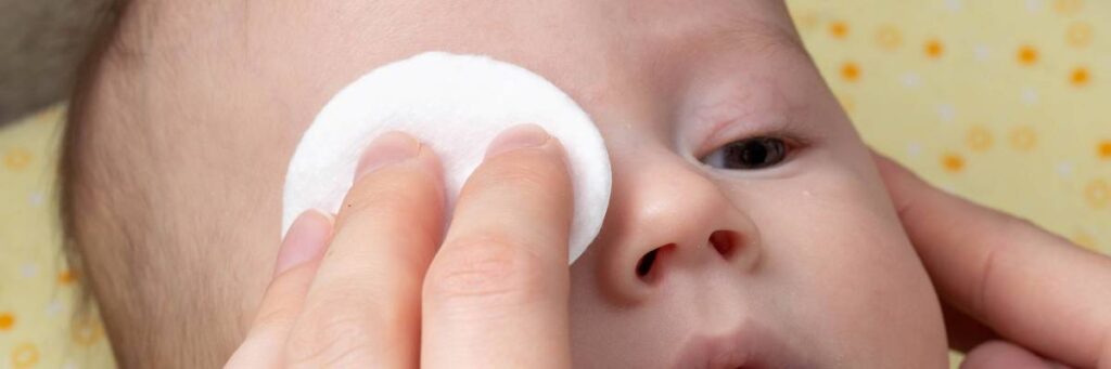 Przecieranie oczków niemowlakowi. Obrazek w artykule Co pomaga na światłowstręt? Odkryj skuteczne metody łagodzenia objawów choroby